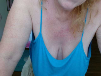 Kallie-Kiss webcam model stream image
